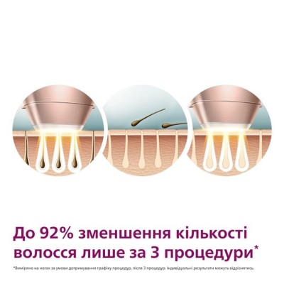 Фотоепілятор Philips Lumea IPL 9900 Series, акумуляторний , кіл-ть спалах.-450000, 2- 4 см2, насадок-4, футляр, рожевий (BRI977/